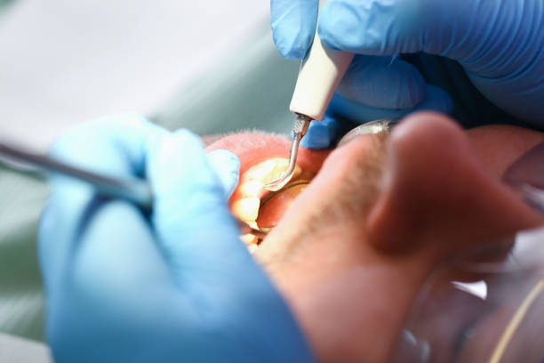Best Dentist for Tooth Abscess  in Osawatomie, KS
